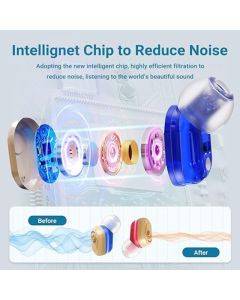 XIYNBH Hearing Aids, Rechargeable Hearing Aids