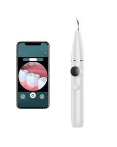 Dental plaque and calculus remover, oral cleaning, ultrasonic cleaning, electric visual cleaning device